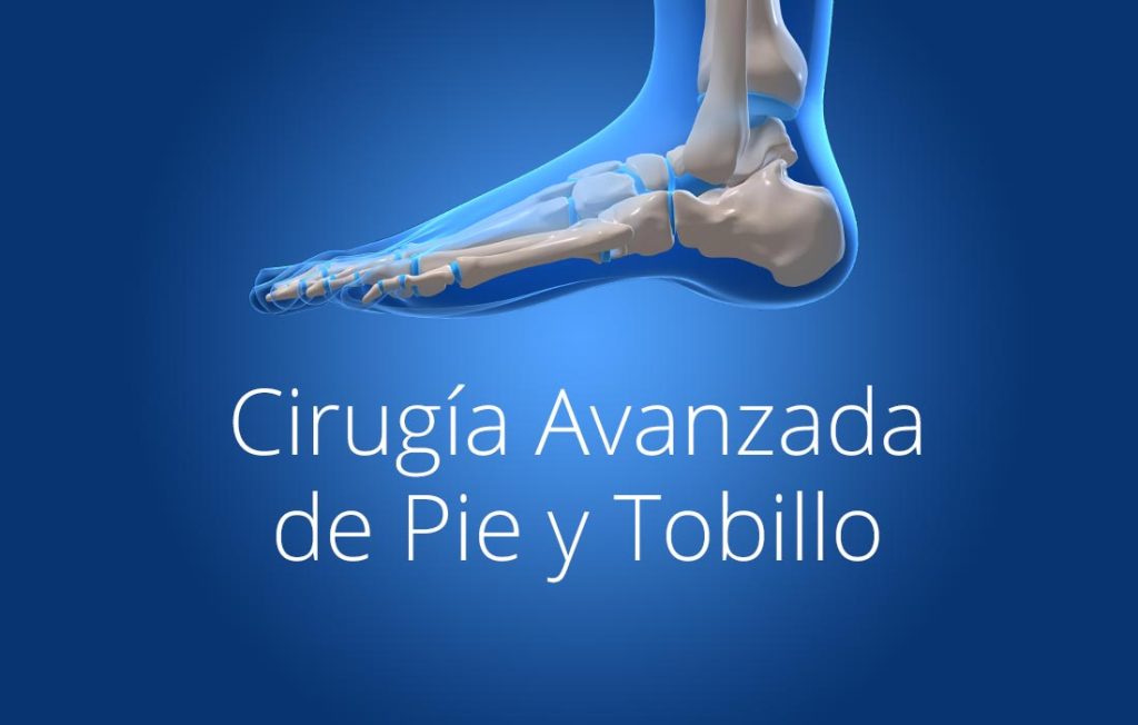 cirugia-avanzada-de-pie-y-tobillo